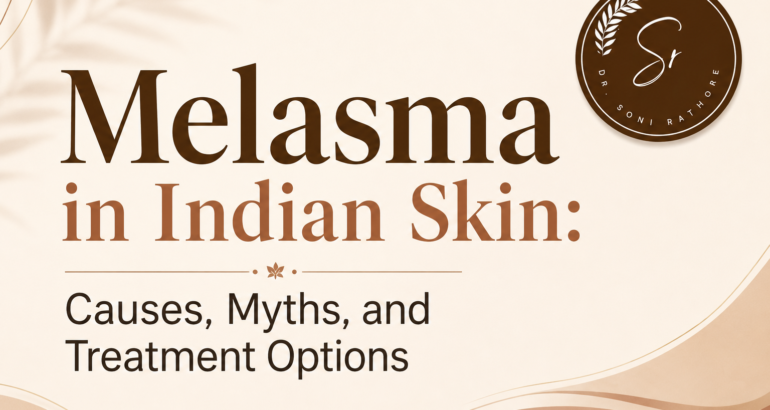 Melasma in Indian Skin: Causes, Myths, and Treatment Options